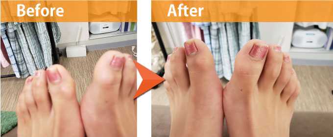 脚の長さ調整法3